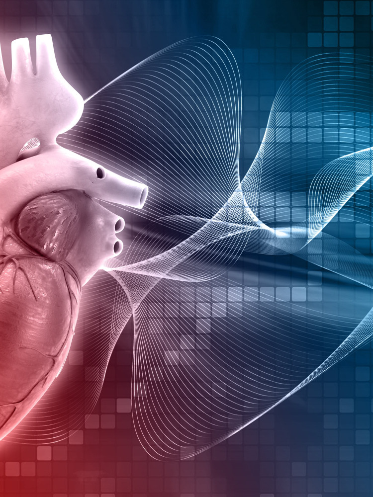 STRUCTURAL HEART DISEASE DEPARTMENT
